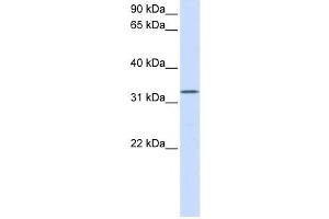 Western Blotting (WB) image for anti-Docking Protein 5 (DOK5) antibody (ABIN2458661) (DOK5 抗体)