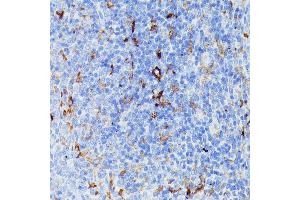 Immunohistochemistry of paraffin-embedded rat spleen using MMP25 antibody (ABIN7268422) at dilution of 1:100 (40x lens). (MMP25 抗体  (AA 350-540))