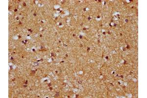 IHC image of ABIN7164031 diluted at 1:500 and staining in paraffin-embedded human brain tissue performed on a Leica BondTM system. (HCN1 抗体  (AA 784-887))