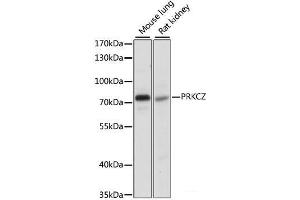 Western blot analysis of extracts of various cell lines using PRKCZ Polyclonal Antibody at dilution of 1:1000. (PKC zeta 抗体)