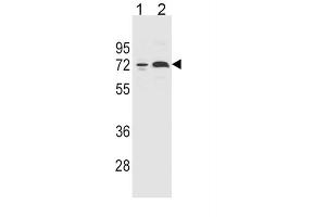 Western Blotting (WB) image for anti-Cytochrome P450, Family 2, Subfamily B, Polypeptide 6 (CYP2B6) antibody (ABIN5015645) (CYP2B6 抗体)