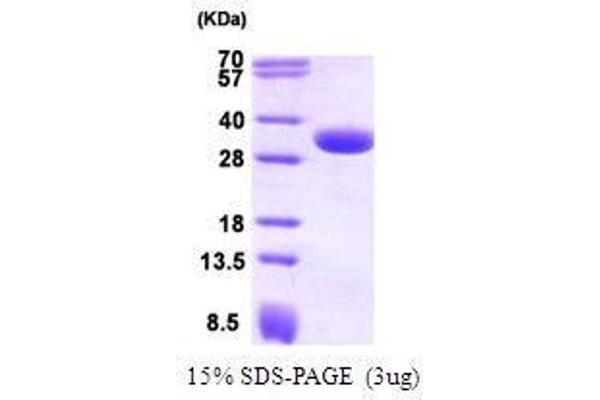 CBR1 Protein (AA 1-277)