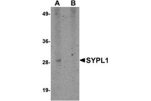 Western blot analysis of SYPL1 in human brain tissue lysate with this product at 1 μg/ml in (A) the absence and (B) the presence of blocking peptide. (SYPL1 抗体  (N-Term))