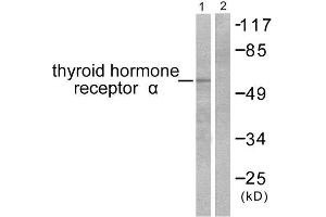 Western Blotting (WB) image for anti-Thyroid Hormone Receptor, alpha (THRA) (N-Term) antibody (ABIN1848805) (THRA 抗体  (N-Term))