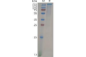 LY75/DEC-205 Protein (AA 19-1666) (His tag)