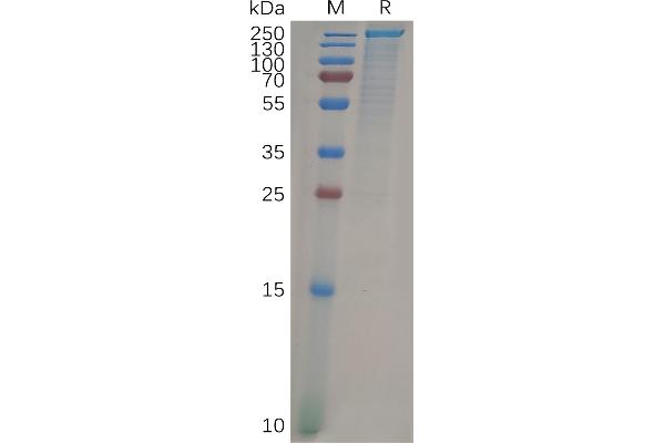 LY75/DEC-205 Protein (AA 19-1666) (His tag)