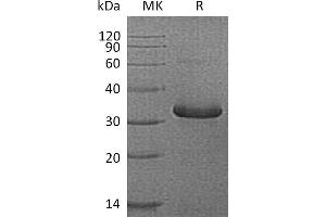 Greater than 95 % as determined by reducing SDS-PAGE. (IGFBPI Protein (His tag))