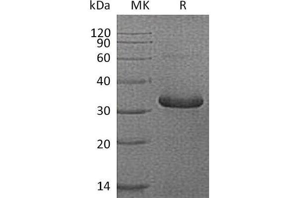 IGFBPI Protein (His tag)