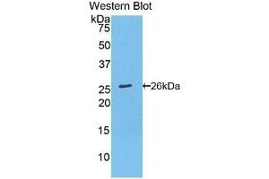 Detection of Recombinant Bcl2, Mouse using Polyclonal Antibody to B-Cell Leukemia/Lymphoma 2 (Bcl2) (Bcl-2 抗体  (AA 2-208))