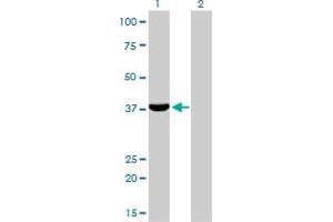 Western Blotting (WB) image for anti-Aldo-keto Reductase Family 1 Member C4 (AKR1C4) (AA 1-323) antibody (ABIN560358)