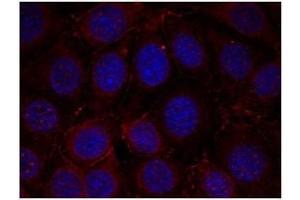 Image no. 1 for anti-Insulin-Like Growth Factor 1 Receptor (IGF1R) (pTyr1165), (pTyr1166) antibody (ABIN196774) (IGF1R 抗体  (pTyr1165, pTyr1166))