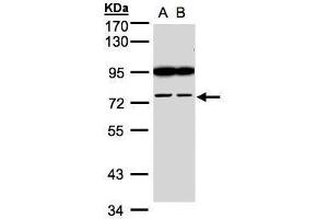 WB Image Sample(30 ug whole cell lysate) A:H1299 B:HeLa S3, 7. (FSD2 抗体  (N-Term))