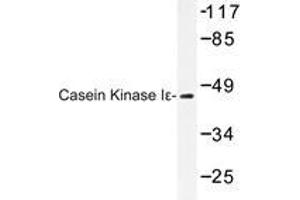 Western blot analysis of Casein Kinase Iε antibody in extracts from LOVO cells. (CK1 epsilon 抗体)