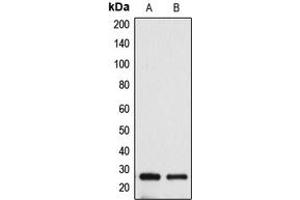 Western blot analysis of BAK expression in HeLa (A), A431 (B) whole cell lysates. (BAK1 抗体  (N-Term))