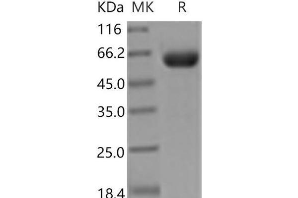 EPH Receptor A7 Protein (EPHA7) (His tag)