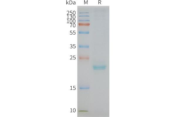 Claudin 3 Protein (CLDN3)