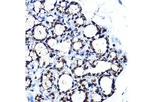 Immunohistochemistry of paraffin-embedded rat brown adipose using PPARγ Rabbit pAb (ABIN6134090, ABIN6146004, ABIN6146006 and ABIN6215096) at dilution of 1:250 (40x lens). (PPARG 抗体  (AA 70-170))