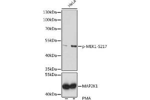 Western blot analysis of extracts of HeLa cells, using Phospho-MEK1-S217 pAb  at 1:1000 dilution or MEK1 antibody (ABIN6134386, ABIN6143481, ABIN6143482 and ABIN7101408). (MEK1 抗体  (pSer217))