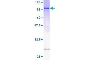 Image no. 1 for 5'-Nucleotidase, Cytosolic II (NT5C2) (AA 1-561) protein (GST tag) (ABIN1313090) (NT5C2 Protein (AA 1-561) (GST tag))