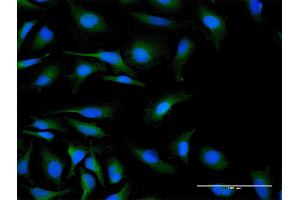 Immunofluorescence of purified MaxPab antibody to C19orf10 on HeLa cell. (C19orf10 抗体  (AA 1-173))