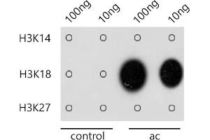 Dot-blot analysis of all sorts of methylation peptides using Acetyl-Histone H3-K18 antibody (ABIN7267668) at 1:1000 dilution. (Histone 3 抗体  (H3K18))