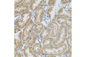Immunohistochemistry of paraffin-embedded rat kidney using MMP10 antibody (ABIN1873714) at dilution of 1:100 (40x lens). (MMP10 抗体)