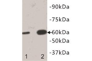 Western Blotting (WB) image for anti-Interleukin 13 Receptor, alpha 1 (IL13RA1) antibody (ABIN1854925) (IL13 Receptor alpha 1 抗体)