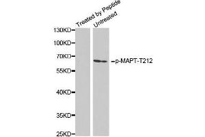 Western Blotting (WB) image for anti-Microtubule-Associated Protein tau (MAPT) (pThr212) antibody (ABIN3020349) (MAPT 抗体  (pThr212))