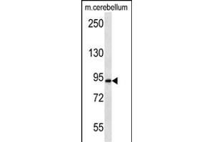 BA2 Antibody (Center) 12659c western blot analysis in mouse cerebellum tissue lysates (35 μg/lane). (APBA2 抗体  (AA 307-336))