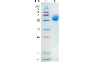 KIT Ligand Protein (KITLG) (AA 26-214) (Fc Tag)