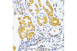 Immunohistochemistry of paraffin-embedded human stomach using MMP2 antibody (ABIN5973678) at dilution of 1/100 (40x lens). (MMP2 抗体)