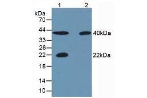 Western blot analysis of (1) Porcine Skeletal Muscle Tissue, (2) Rat Skeletal Muscle Tissue, (3) Human Liver Tissue and (4) Human Lung Tissue. (CA3 抗体  (AA 2-260))