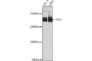 Western blot analysis of extracts of various cell lines, using TSC2 antibody (ABIN7271027) at 1:1000 dilution. (Tuberin 抗体)