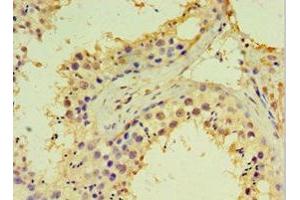 Immunohistochemistry of paraffin-embedded human testis tissue using ABIN7144984 at dilution of 1:100 (DDX39 抗体  (AA 178-427))