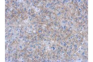 Immunohistochemistry (IHC) image for anti-Catenin (Cadherin-Associated Protein), beta 1, 88kDa (CTNNB1) (N-Term) antibody (ABIN2855042)