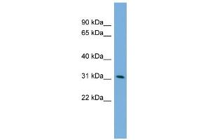 WB Suggested Anti-PPM1M Antibody Titration: 0. (PPM1M 抗体  (Middle Region))