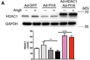 Western Blotting (WB) image for anti-Histone Deacetylase 1 (HDAC1) antibody (ABIN2854776)