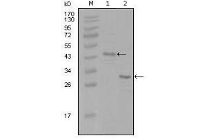 Western Blot showing ESR1 antibody used against truncated Trx-ESR1 recombinant protein (1) and truncated ESR1 (aa130-339)-His recombinant protein (2). (Estrogen Receptor alpha 抗体  (AA 130-339))