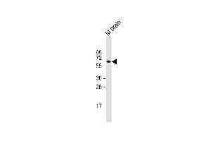 Western Blot at 1:2000 dilution + mouse brain lysate Lysates/proteins at 20 ug per lane. (ZNF238 抗体  (AA 318-331))