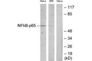 Western blot analysis of extracts from HeLa/293 cells, using NF-kappaB p65 (Ab-468) Antibody. (NF-kB p65 抗体  (AA 435-484))