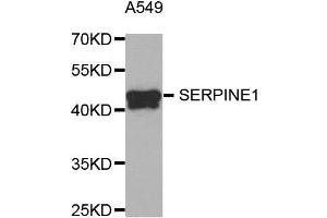 Western Blotting (WB) image for anti-Plasminogen Activator Inhibitor 1 (SERPINE1) antibody (ABIN1882338) (PAI1 抗体)