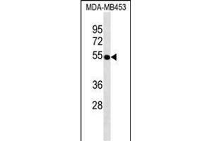 VDR Antibody ABIN1539943 western blot analysis in MDA-M cell line lysates (35 μg/lane). (Vitamin D Receptor 抗体)