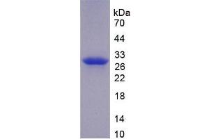 SDS-PAGE analysis of recombinant Mouse F11 Protein. (Factor XI 蛋白)