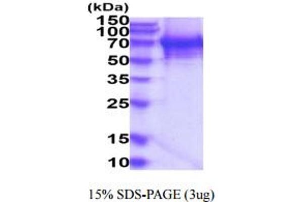 TDP1 Protein (AA 1-608) (His tag)