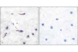 Immunohistochemistry analysis of paraffin-embedded human brain tissue, using MARCKS (Ab-163) Antibody. (MARCKS 抗体  (AA 136-185))