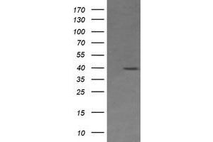 Image no. 1 for anti-Mitogen-Activated Protein Kinase Kinase 3 (MAP2K3) antibody (ABIN1499408) (MAP2K3 抗体)