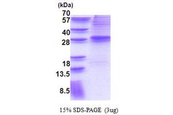 MECOM Protein (AA 1-169) (His tag)