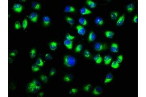 Immunofluorescence staining of Hela cells with ABIN7146972 at 1:333, counter-stained with DAPI. (CTNNA1 抗体  (AA 1-288))