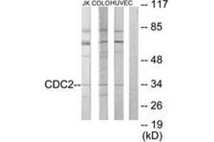 Western blot analysis of extracts from COLO205/HuvEc/Jurkat cells, using CDC2 Antibody. (CDK1 抗体  (AA 101-150))