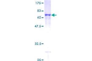 Phosducin-Like Protein (PDCL) (AA 1-301) (GST tag)